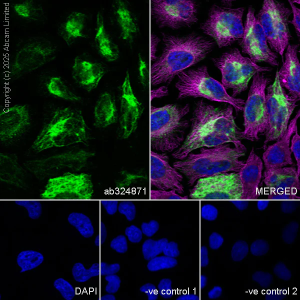 Immunocytochemistry/ Immunofluorescence - Goat Anti-Mouse IgG H&L (Alexa Fluor® 594) preadsorbed (AB150120)