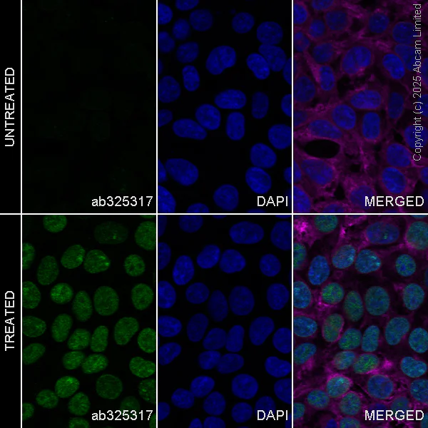 Immunocytochemistry/ Immunofluorescence - Goat Anti-Mouse IgG H&L (Alexa Fluor® 594) preadsorbed (AB150120)