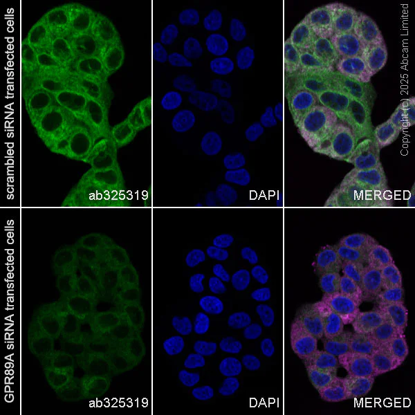 Immunocytochemistry/ Immunofluorescence - Goat Anti-Mouse IgG H&L (Alexa Fluor® 594) preadsorbed (AB150120)