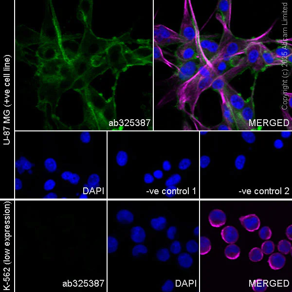 Immunocytochemistry/ Immunofluorescence - Goat Anti-Mouse IgG H&L (Alexa Fluor® 594) preadsorbed (AB150120)