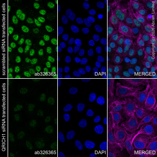 Immunocytochemistry/ Immunofluorescence - Goat Anti-Mouse IgG H&L (Alexa Fluor® 594) preadsorbed (AB150120)