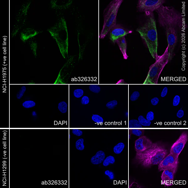 Immunocytochemistry/ Immunofluorescence - Goat Anti-Mouse IgG H&L (Alexa Fluor® 594) preadsorbed (AB150120)