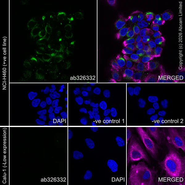 Immunocytochemistry/ Immunofluorescence - Goat Anti-Mouse IgG H&L (Alexa Fluor® 594) preadsorbed (AB150120)