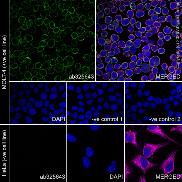 Immunocytochemistry/ Immunofluorescence - Goat Anti-Mouse IgG H&L (Alexa Fluor® 594) preadsorbed (AB150120)