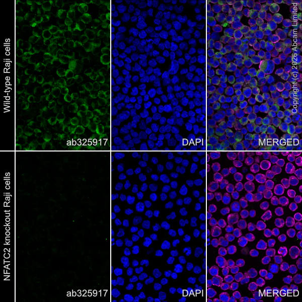 Immunocytochemistry/ Immunofluorescence - Goat Anti-Mouse IgG H&L (Alexa Fluor® 594) preadsorbed (AB150120)