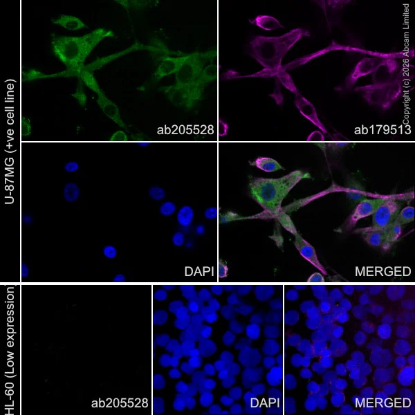 Immunocytochemistry/ Immunofluorescence - Goat Anti-Mouse IgG H&L (Alexa Fluor® 594) preadsorbed (AB150120)