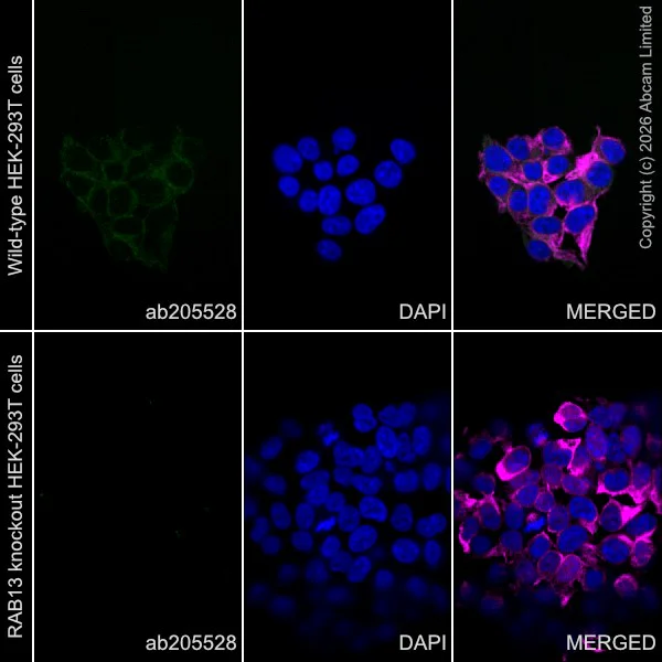 Immunocytochemistry/ Immunofluorescence - Goat Anti-Mouse IgG H&L (Alexa Fluor® 594) preadsorbed (AB150120)