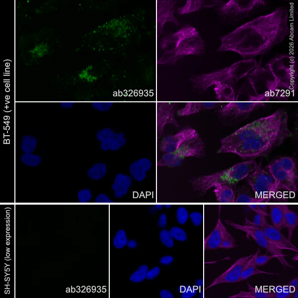 Immunocytochemistry/ Immunofluorescence - Goat Anti-Mouse IgG H&L (Alexa Fluor® 594) preadsorbed (AB150120)