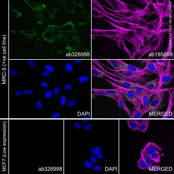 Immunocytochemistry/ Immunofluorescence - Goat Anti-Mouse IgG H&L (Alexa Fluor® 594) preadsorbed (AB150120)