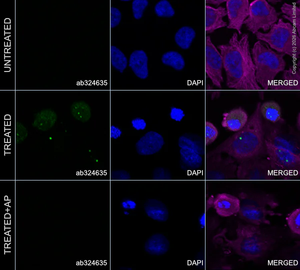 Immunocytochemistry/ Immunofluorescence - Goat Anti-Mouse IgG H&L (Alexa Fluor® 594) preadsorbed (AB150120)
