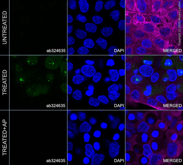 Immunocytochemistry/ Immunofluorescence - Goat Anti-Mouse IgG H&L (Alexa Fluor® 594) preadsorbed (AB150120)