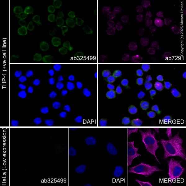 Immunocytochemistry/ Immunofluorescence - Goat Anti-Mouse IgG H&L (Alexa Fluor® 594) preadsorbed (AB150120)