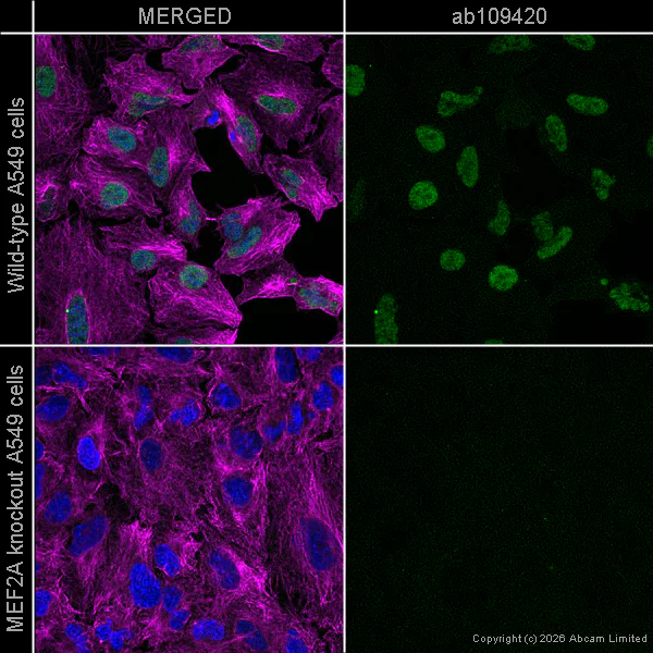 Immunocytochemistry/ Immunofluorescence - Goat Anti-Mouse IgG H&L (Alexa Fluor® 594) preadsorbed (AB150120)