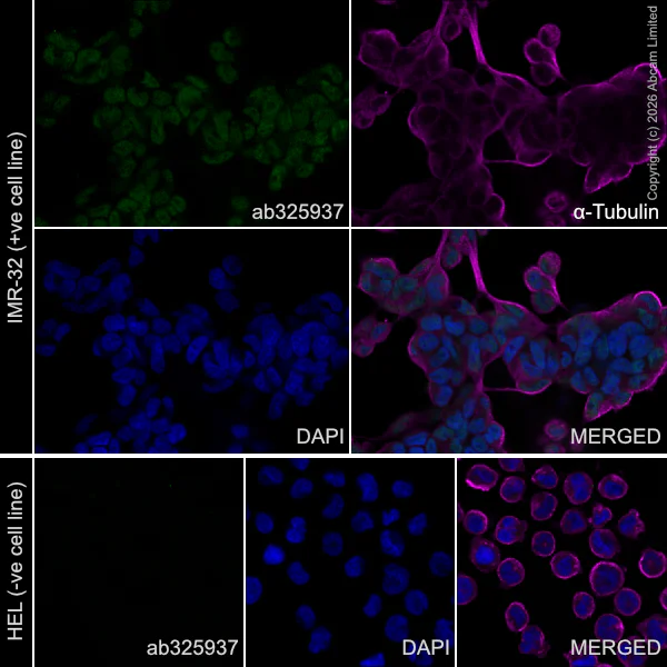 Immunocytochemistry/ Immunofluorescence - Goat Anti-Mouse IgG H&L (Alexa Fluor® 594) preadsorbed (AB150120)