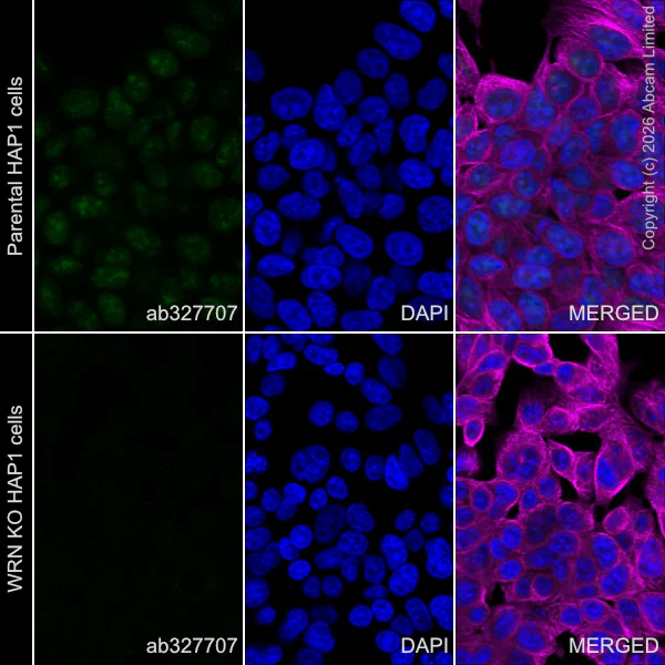 Immunocytochemistry/ Immunofluorescence - Goat Anti-Mouse IgG H&L (Alexa Fluor® 594) preadsorbed (AB150120)