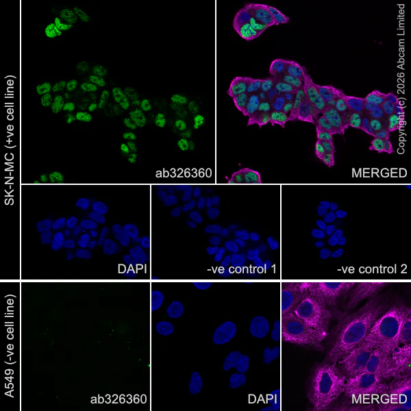 Immunocytochemistry/ Immunofluorescence - Goat Anti-Mouse IgG H&L (Alexa Fluor® 594) preadsorbed (AB150120)