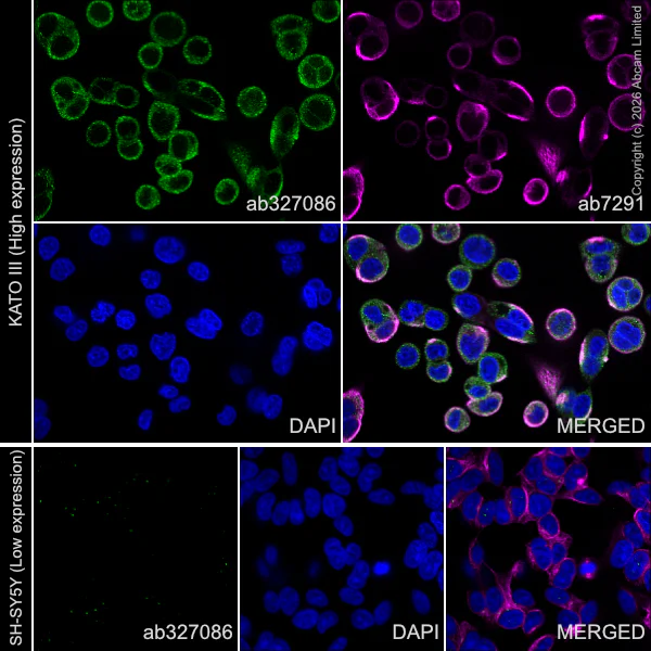 Immunocytochemistry/ Immunofluorescence - Goat Anti-Mouse IgG H&L (Alexa Fluor® 594) preadsorbed (AB150120)