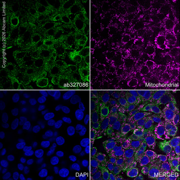 Immunocytochemistry/ Immunofluorescence - Goat Anti-Mouse IgG H&L (Alexa Fluor® 594) preadsorbed (AB150120)