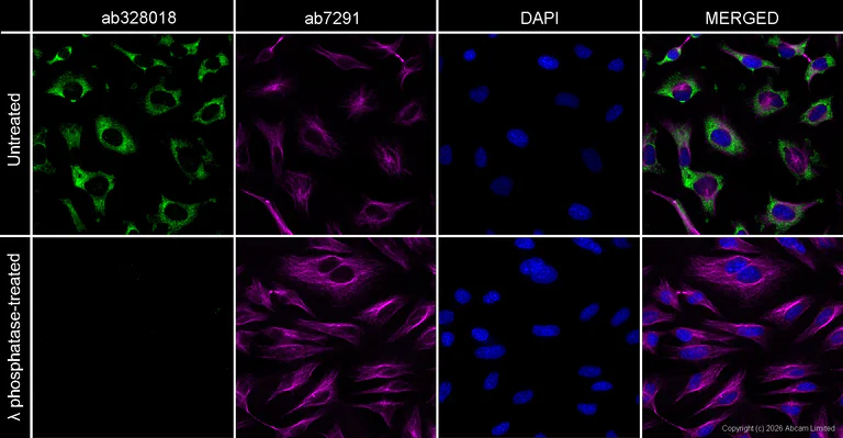 Immunocytochemistry/ Immunofluorescence - Goat Anti-Mouse IgG H&L (Alexa Fluor® 594) preadsorbed (AB150120)