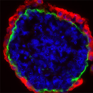 Immunohistochemistry (Formalin/PFA-fixed paraffin-embedded sections) - Goat Anti-Mouse IgG H&L (Alexa Fluor® 594) preadsorbed (AB150120), expandable thumbnail