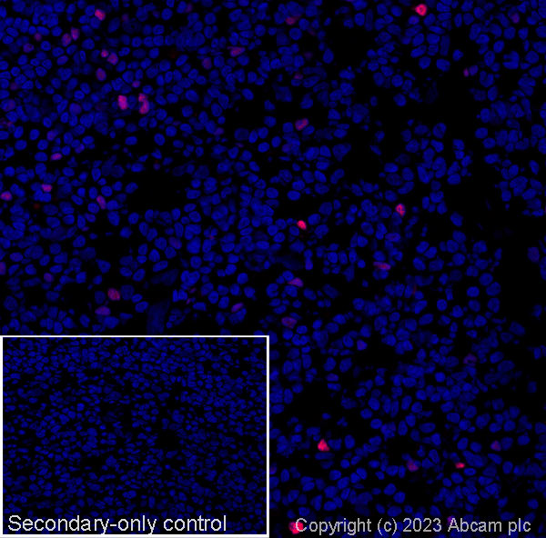 Immunohistochemistry (Frozen sections) - Goat Anti-Mouse IgG H&L (Alexa Fluor® 594) preadsorbed (ab150120), expandable thumbnail