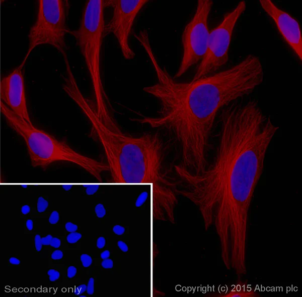 Immunocytochemistry/ Immunofluorescence - Goat Anti-Mouse IgG H&L (Alexa Fluor® 647) preadsorbed (AB150119)