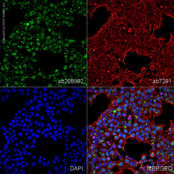 Immunocytochemistry/ Immunofluorescence - Goat Anti-Mouse IgG H&L (Alexa Fluor® 647) preadsorbed (AB150119)
