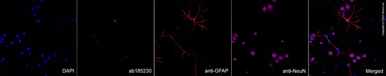 Immunocytochemistry/ Immunofluorescence - Goat Anti-Mouse IgG H&L (Alexa Fluor® 647) preadsorbed (AB150119)