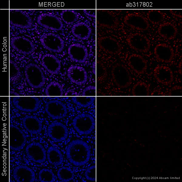Immunohistochemistry (Formalin/PFA-fixed paraffin-embedded sections) - Goat Anti-Mouse IgG H&L (Alexa Fluor® 647) preadsorbed (AB150119)