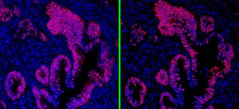 Immunohistochemistry (Formalin/PFA-fixed paraffin-embedded sections) - Goat Anti-Mouse IgG H&L (DyLight® 594) preadsorbed (AB96881)