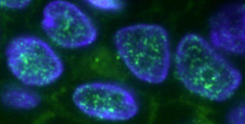 Immunohistochemistry (Formalin/PFA-fixed paraffin-embedded sections) - Goat Anti-Mouse IgG H&L (FITC) (AB6785), expandable thumbnail
