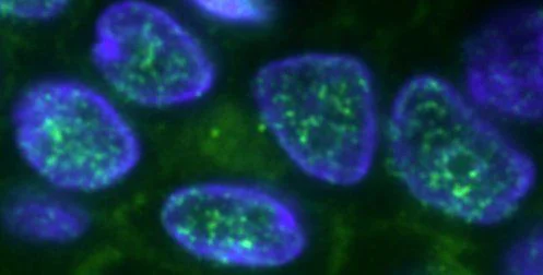 Immunohistochemistry (Formalin/PFA-fixed paraffin-embedded sections) - Goat Anti-Mouse IgG H&L (FITC) (AB6785)