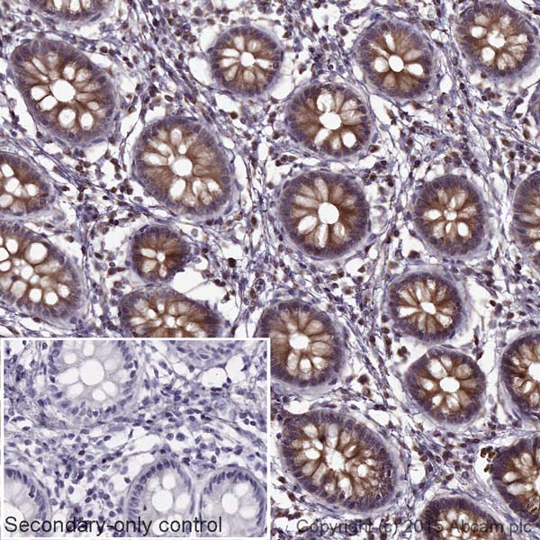 Immunohistochemistry (Formalin/PFA-fixed paraffin-embedded sections) - Goat Anti-Mouse IgG H&L (HRP) (AB205719), expandable thumbnail