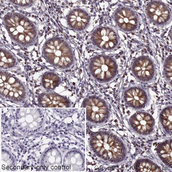 Immunohistochemistry (Formalin/PFA-fixed paraffin-embedded sections) - Goat Anti-Mouse IgG H&L (HRP) (AB205719)
