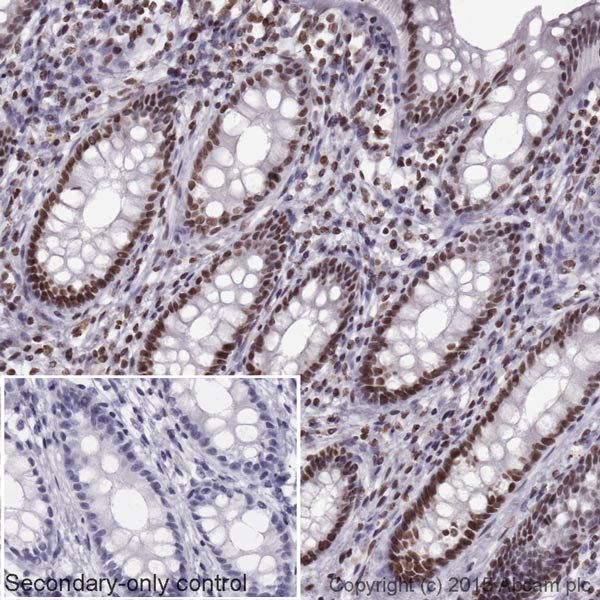 Immunohistochemistry (Formalin/PFA-fixed paraffin-embedded sections) - Goat Anti-Mouse IgG H&L (HRP) (AB205719), expandable thumbnail