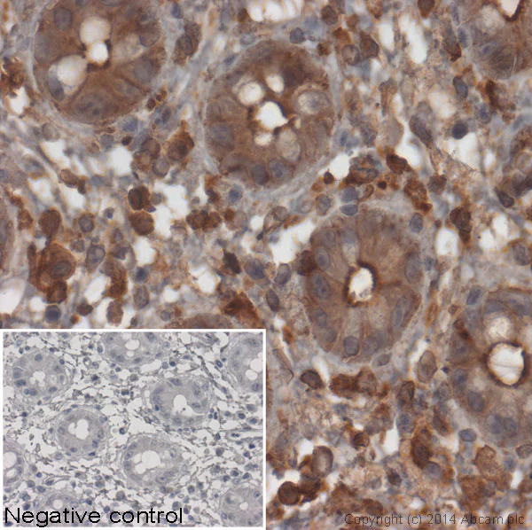 Immunohistochemistry (Formalin/PFA-fixed paraffin-embedded sections) - Goat Anti-Mouse IgG H&L (HRP) (AB97023)