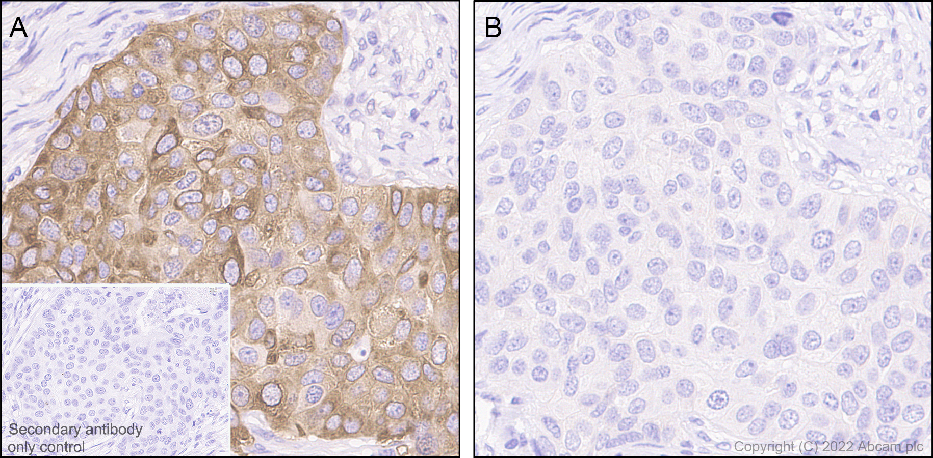 Immunohistochemistry (Formalin/PFA-fixed paraffin-embedded sections) - Goat Anti-Mouse IgG H&L (HRP polymer) (AB214879), expandable thumbnail