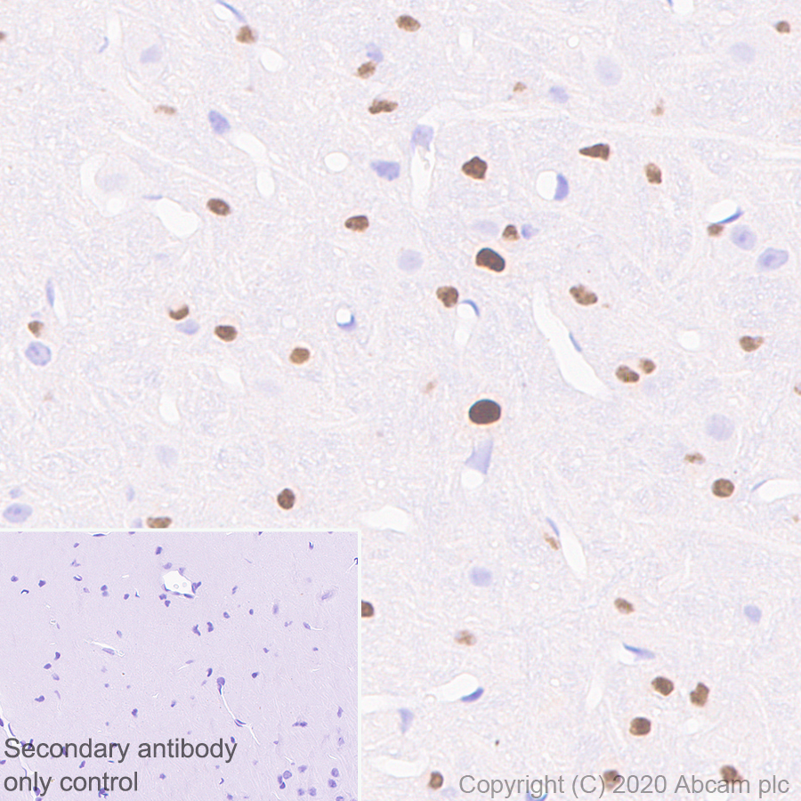 Immunohistochemistry (Formalin/PFA-fixed paraffin-embedded sections) - Goat Anti-Mouse IgG H&L (HRP polymer) (AB214879), expandable thumbnail