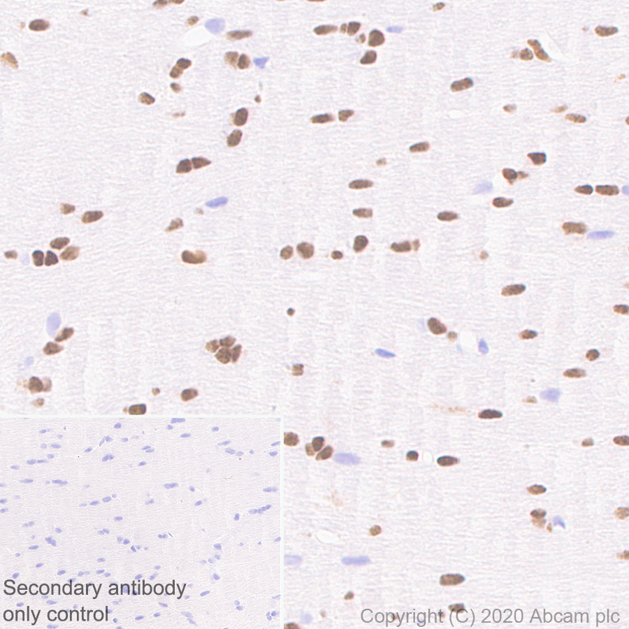 Immunohistochemistry (Formalin/PFA-fixed paraffin-embedded sections) - Goat Anti-Mouse IgG H&L (HRP polymer) (ab214879), expandable thumbnail