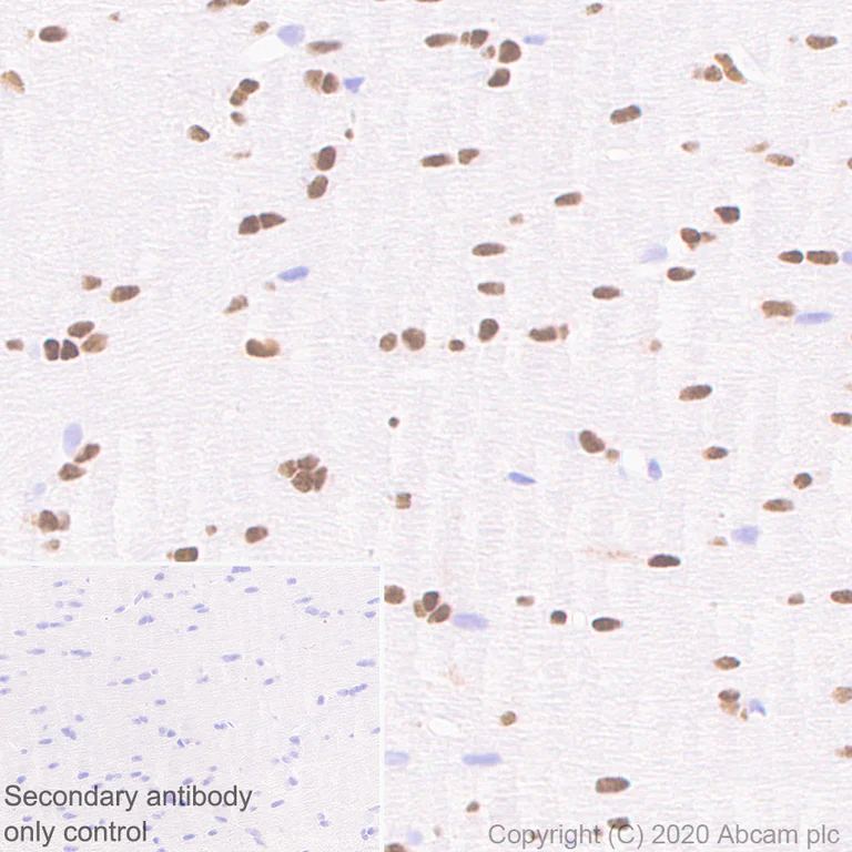 Immunohistochemistry (Formalin/PFA-fixed paraffin-embedded sections) - Goat Anti-Mouse IgG H&L (HRP polymer) (AB214879)