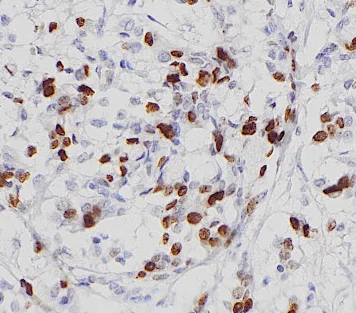 Immunohistochemistry (Formalin/PFA-fixed paraffin-embedded sections) - Goat Anti-Mouse IgG H&L (HRP polymer) (AB214879)
