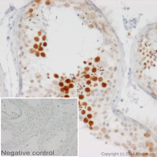 Immunohistochemistry (Formalin/PFA-fixed paraffin-embedded sections) - Goat Anti-Mouse IgG2b heavy chain (HRP) (AB97250), expandable thumbnail
