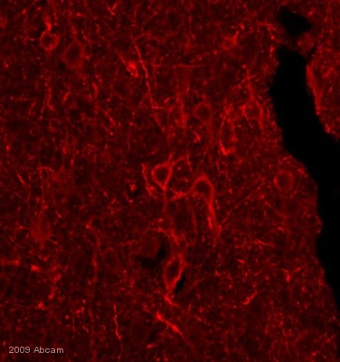 Immunocytochemistry/ Immunofluorescence - Goat Anti-Mouse IgG+IgM H&L (Biotin) preadsorbed (AB47844), expandable thumbnail