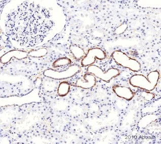 Immunohistochemistry (Formalin/PFA-fixed paraffin-embedded sections) - Goat Anti-Mouse IgG+IgM H&L (HRP) preadsorbed (AB47827)