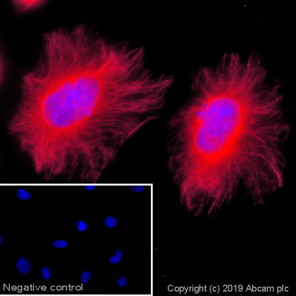 Immunocytochemistry/ Immunofluorescence - Goat Anti-Mouse IgM mu chain (Alexa Fluor® 568) (AB175702)