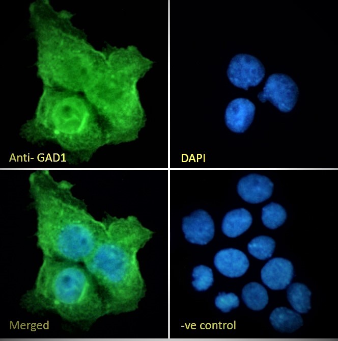 Immunocytochemistry/ Immunofluorescence - Goat polyclonal to GAD67/GAD1 (AB80589), expandable thumbnail