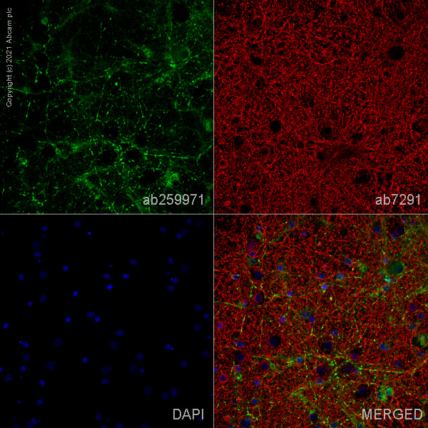 Immunocytochemistry/ Immunofluorescence - Goat Anti-Rabbit IgG H&L (Alexa Fluor® 488) preadsorbed (ab150081), expandable thumbnail