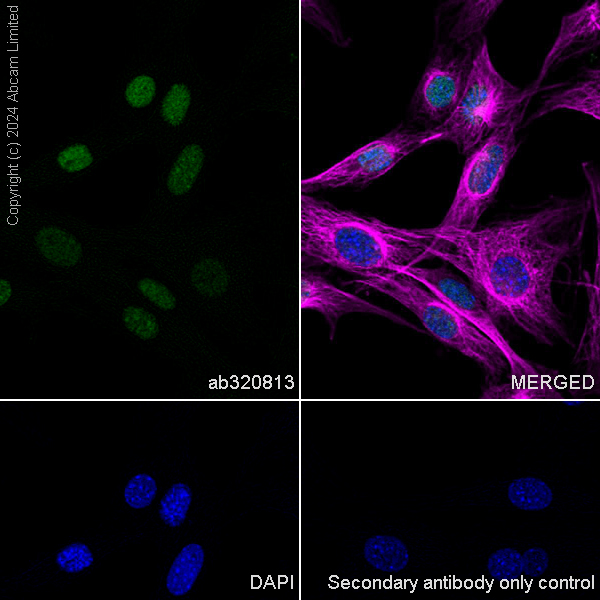 Immunocytochemistry/ Immunofluorescence - Goat Anti-Rabbit IgG H&L (Alexa Fluor® 488) preadsorbed (ab150081), expandable thumbnail
