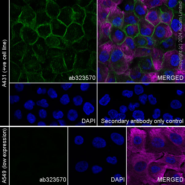 Immunocytochemistry/ Immunofluorescence - Goat Anti-Rabbit IgG H&L (Alexa Fluor® 488) preadsorbed (ab150081), expandable thumbnail