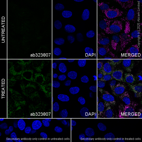 Immunocytochemistry/ Immunofluorescence - Goat Anti-Rabbit IgG H&L (Alexa Fluor® 488) preadsorbed (ab150081), expandable thumbnail